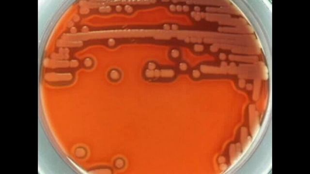bacillus cereus смотреть онлайн