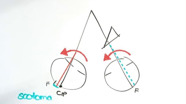 4 Prism Dioptre Test смотреть онлайн