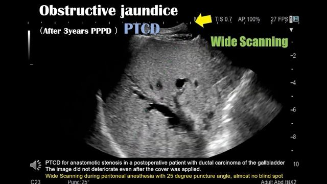 Hepatobiliary & Pancreatic Disease Examinations Webinar смотреть онлайн