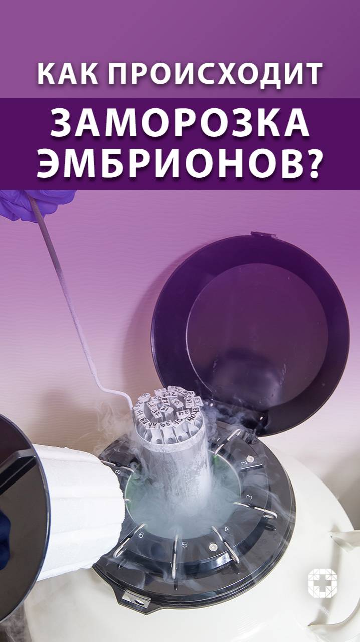 Как происходит заморозка эмбрионов? смотреть онлайн