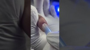 ПРИЧИНЫ ГРЯЗНОГО ОТПЕЧАТКА при работе с верхними формами