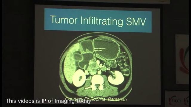 Radiology approach to “Pancreatic Carcinoma from a surgeon’s perspective” смотреть онлайн
