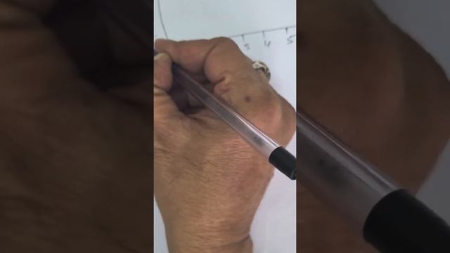 Hepatitis b markers Hbsag Hbcag Hbeag abs sag,cag,eag, simple carrier super carrier immune 100iu/dl смотреть онлайн