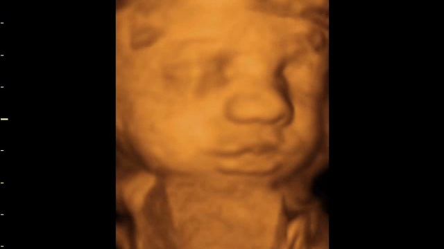 Window to the womb 4d baby scan of tamsin and martin смотреть онлайн