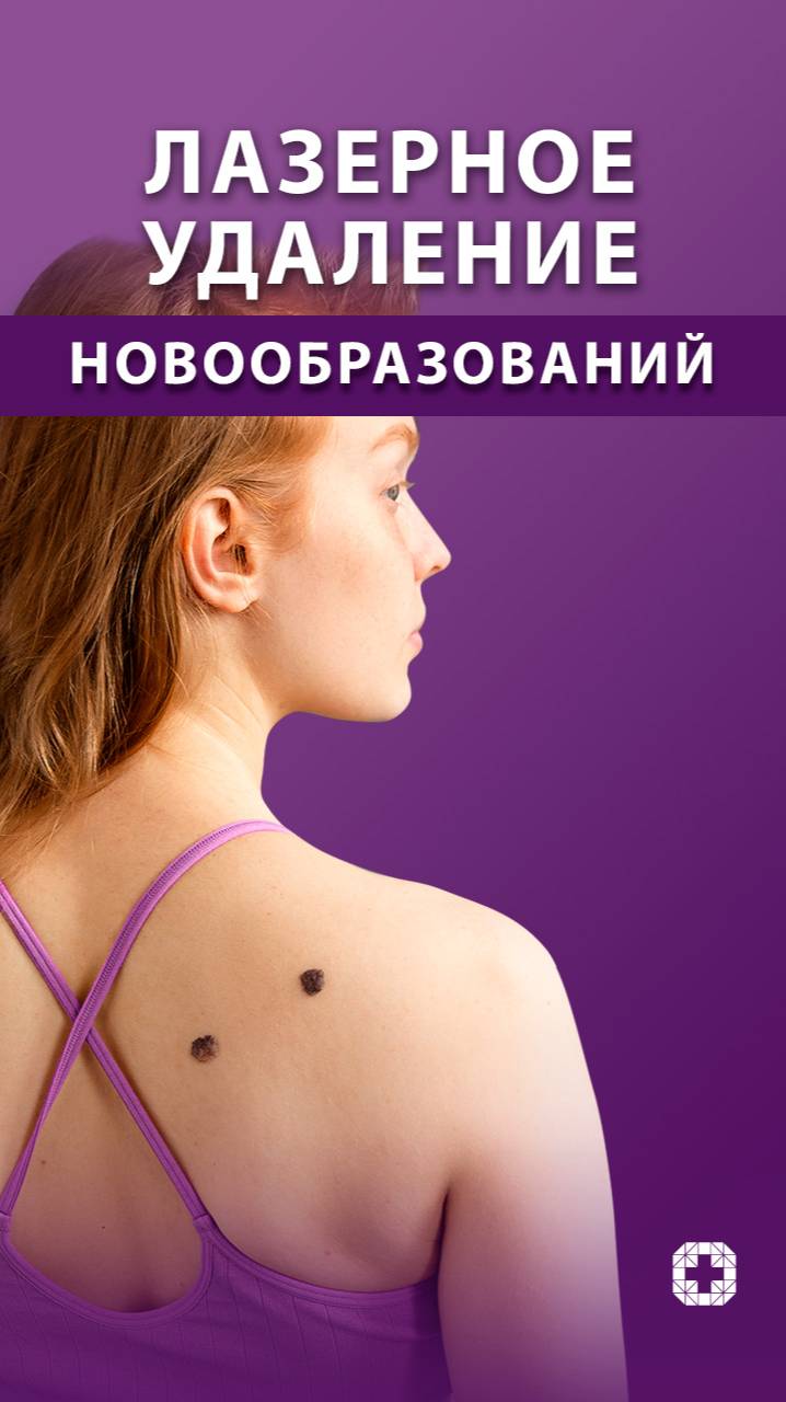 Лазерное удаление новообразований смотреть онлайн