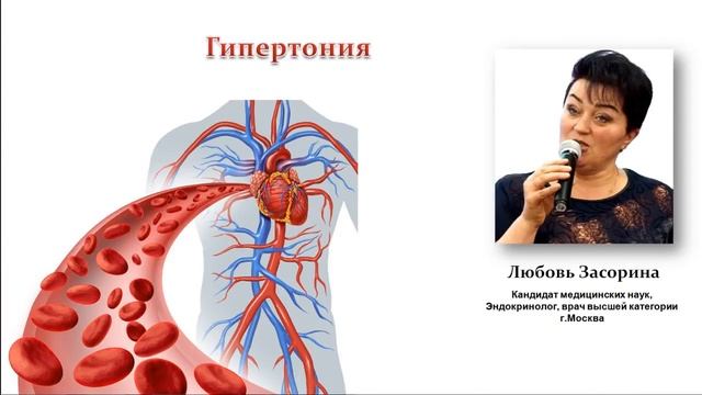 Гипертония врач Любовь Засорина Power Matrix смотреть онлайн