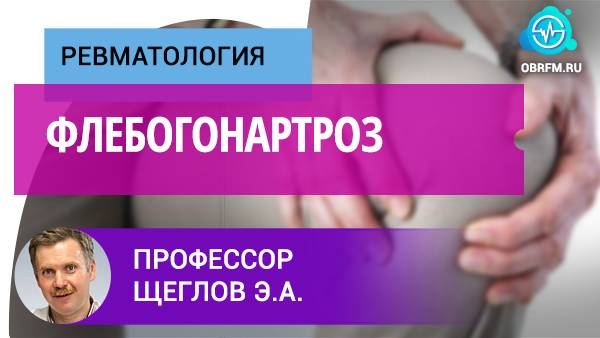 Профессор Щеглов Э.А.: Флебогонартроз смотреть онлайн
