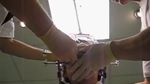 Gamma Knife surgery Part 2: then they make sure it all fits смотреть онлайн