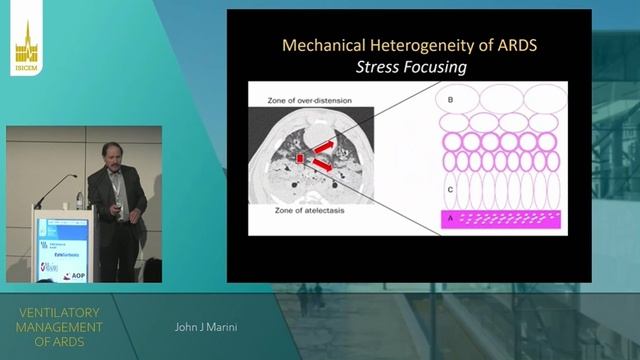 VENTILATORY MANAGEMENT OF ARDS (ISICEM 2022)