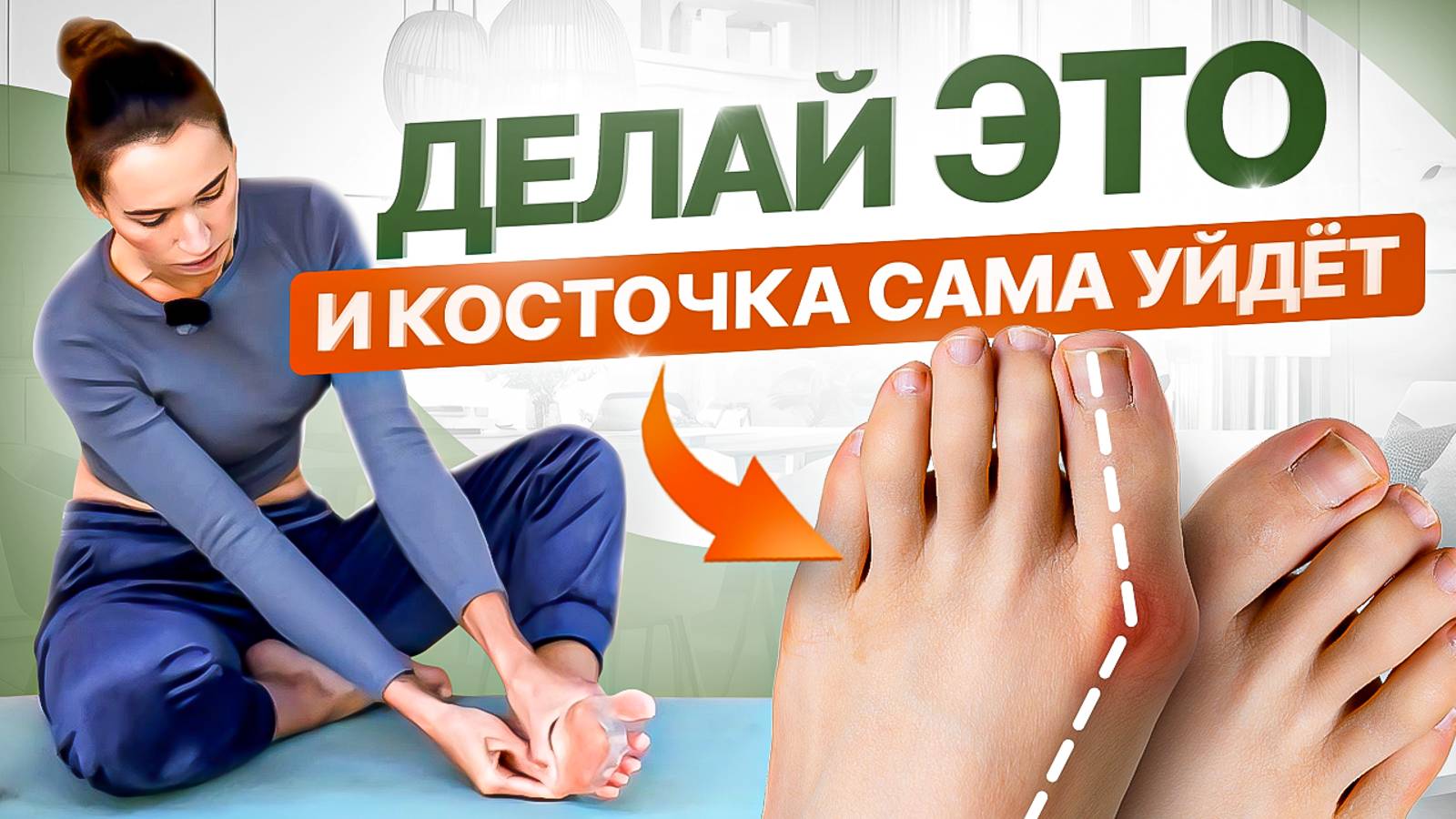 Косточка на большом пальце ноги, плоскостопие и боль в стопах | Делай ЭТИ 4 упражнения смотреть онлайн