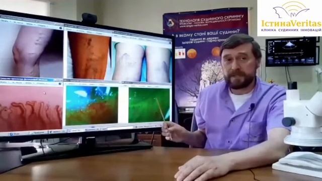 Варикозне розширення вен смотреть онлайн