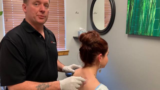Cupping Therapy For Neck And Back Pain @prochiropractic