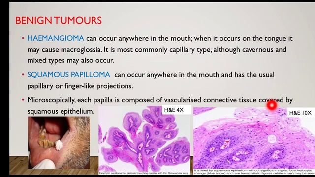 ORAL CAVITY PATHOLOGY смотреть онлайн