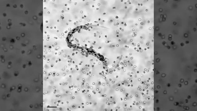Leukotriene B4 Amplifies Eosinophil Accumulation in Response to Nematodes смотреть онлайн