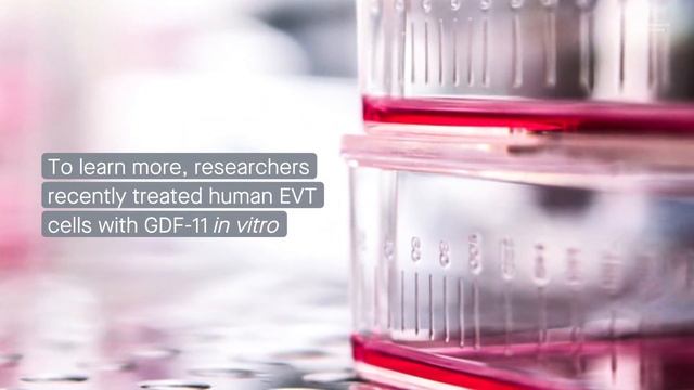 GDF-11 promotes extravillous trophoblast cell invasion to aid in placenta development смотреть онлайн