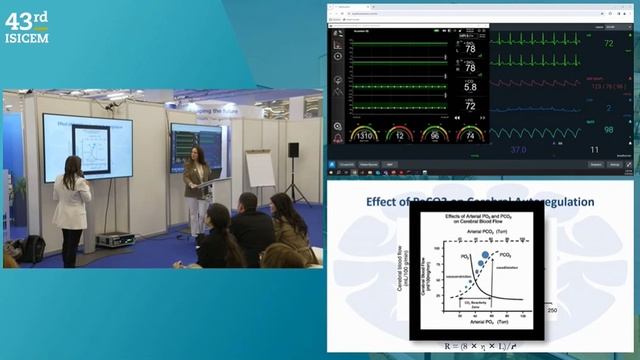 IMPORTANCE OF PERFUSION MONITORING IN THE ICU  ISICEM 2024 (43)