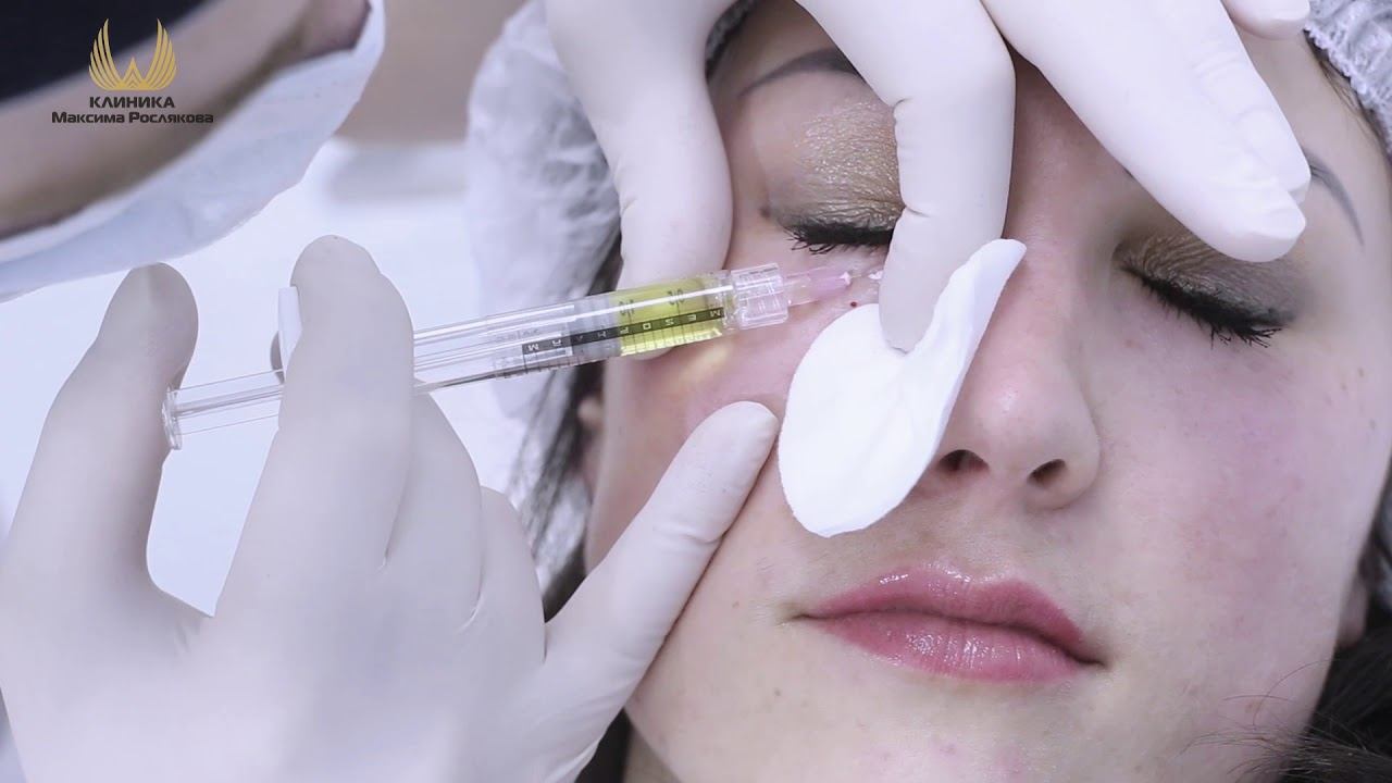 Пептидная мезотерапия