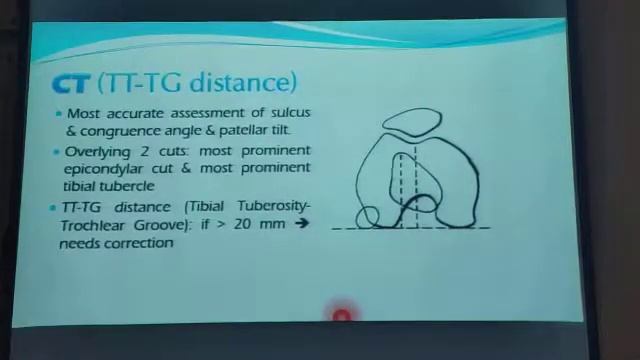Acute and recurrent knee dislocation смотреть онлайн