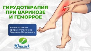 Гирудотерапия против варикоза и геморроя