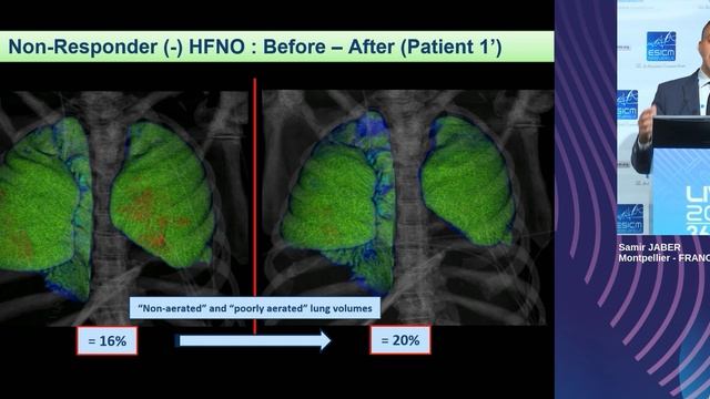 You say BiPAP… I say CPAP Samir Jaber (ESICM 2023)