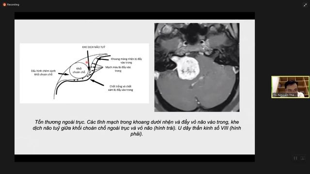 CT và MRI Mô não смотреть онлайн