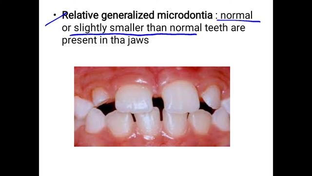 Microdontia смотреть онлайн