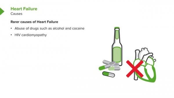 01. Heart Failure