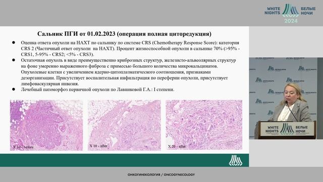 Синхронный рак яичника и  эндометрия, ассоциированный с беременностью. Клинический случай /#WNOF202