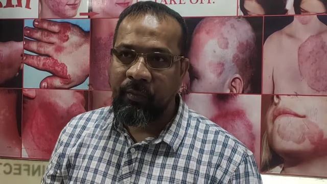 fungal infection on Scalp (tinea capitis ) смотреть онлайн