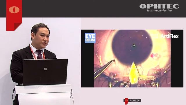 Comparison between Artiflex Toric and limbal relaxing incisions for correcting myopic astigmatism смотреть онлайн