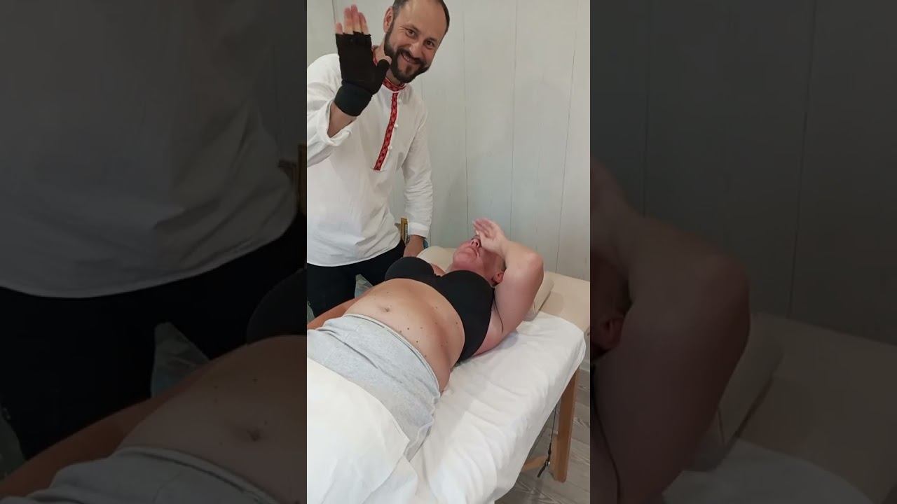 Женщина 30 лет.Сколиоз кифозного и S образного типа,ротация КПС.