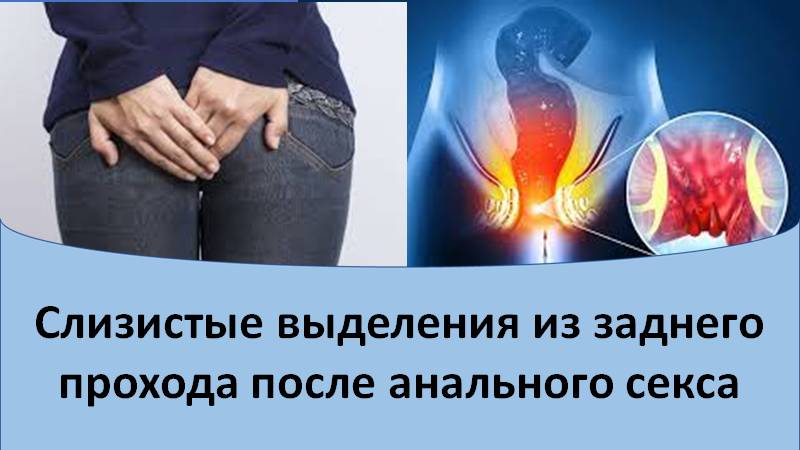 Слизистые выделения из заднего прохода после анального секса смотреть онлайн
