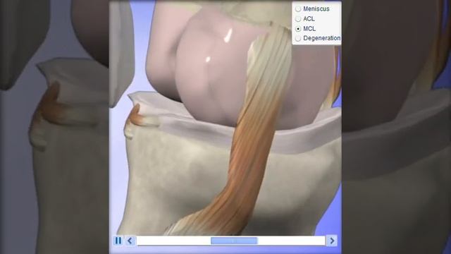 Knee MCL смотреть онлайн