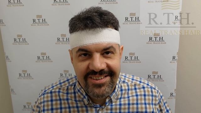 До и сразу после пересадки волос!1200 трансплантатов! смотреть онлайн