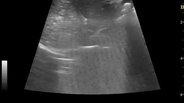 желчный пузырь 1 смотреть онлайн