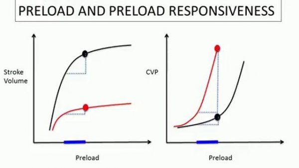 CONSERVATIVE FLUID MANAGEMENT
