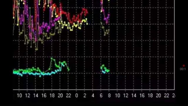 Всплеск и исчезновение графиков. Смотрим на время. 29 июля 2023 Резонанс Шумана смотреть онлайн