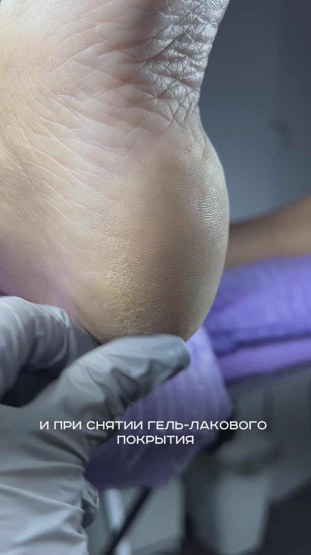 Вытяжка 4BLANC Alize идеальна для защиты здоровья и создания благоприятных условий в кабинете смотреть онлайн