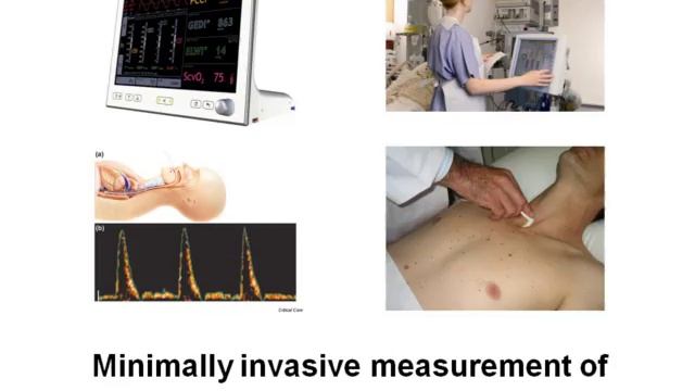 Can we improve outcome, and how Rupert PEARSE summer Buda2011