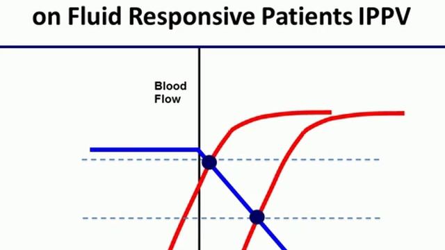 USE OF ASSISTED VENTILATION TO DETERMINE VOLUME RESPONSIVENESS KEY CONCEPTS