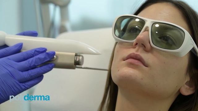 Pomlađivanje lica frakcijskim laserom FRAC 3 смотреть онлайн