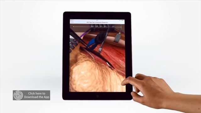 Touch Surgery Simulation - PAP Flap