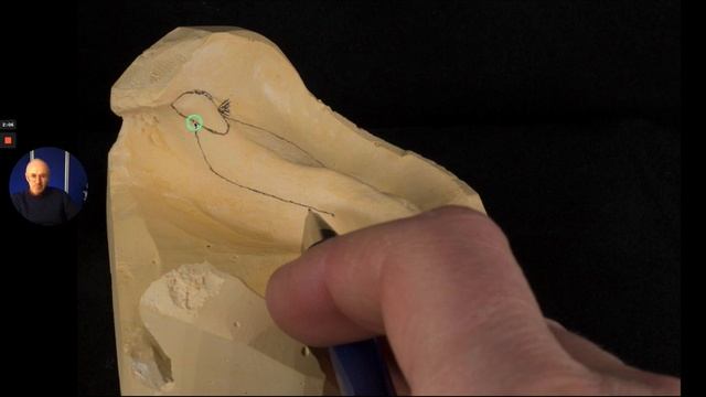 Complete denture lower custom special tray design - Finlay describes how to design this смотреть онлайн