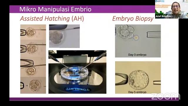 Fertilisasi In Vitro dan Prospek Sebagai Embryologist - Kuliah Tamu Embriologi смотреть онлайн
