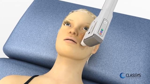 Ultraformer