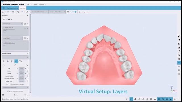 Maestro 3D Ortho Studio V5