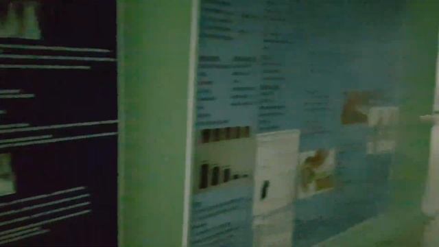 A day with stones and instuments methods in urology #orenburgstatemedicaluniversity смотреть онлайн