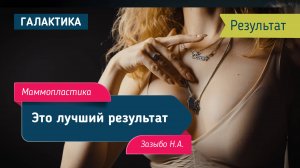Результат после маммопластики, через 7 месяцев | Зазыбо Николай Александрович