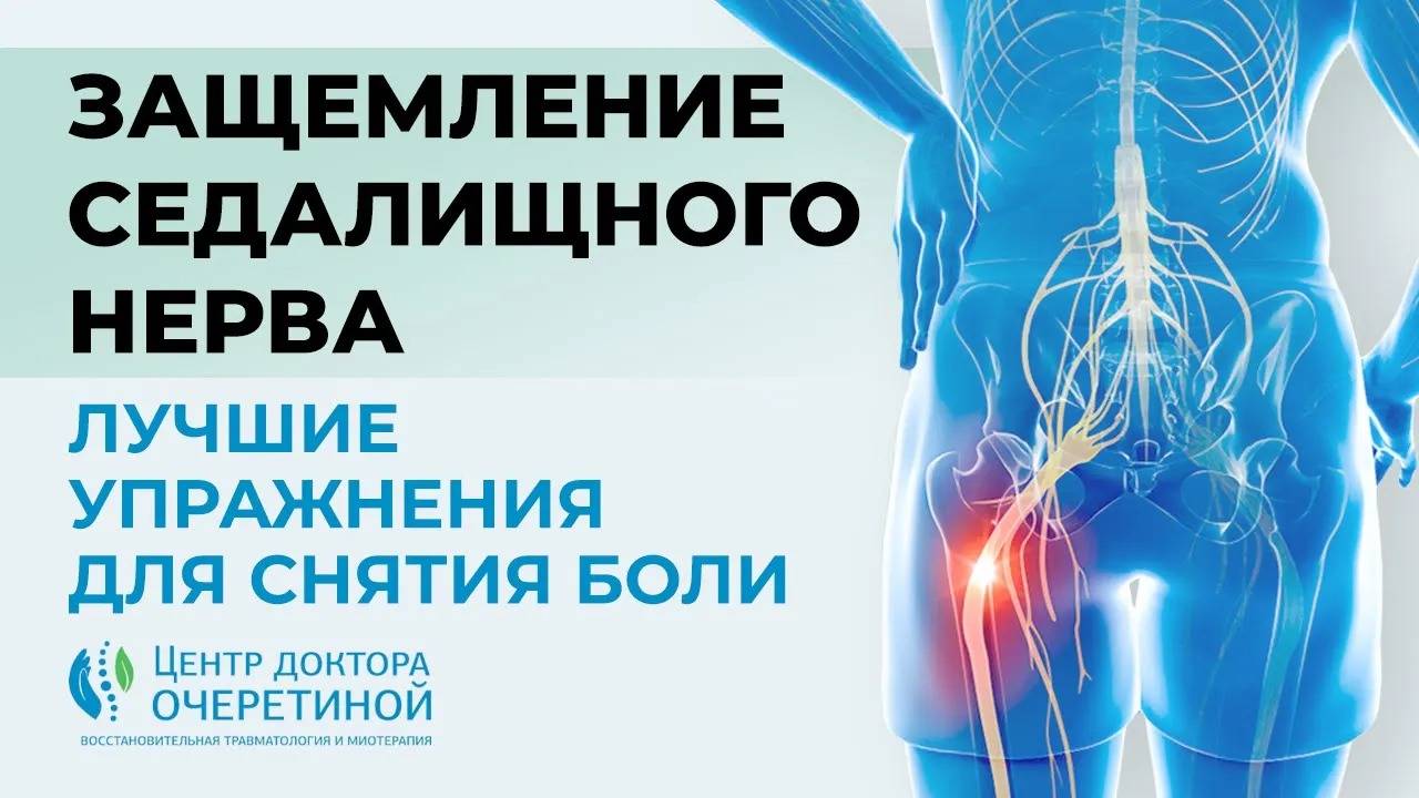 Избавляемся от БОЛИ при ЗАЩЕМЛЕНИИ СЕДАЛИЩНОГО НЕРВА смотреть онлайн