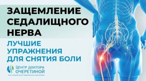 Избавляемся от БОЛИ при ЗАЩЕМЛЕНИИ СЕДАЛИЩНОГО НЕРВА